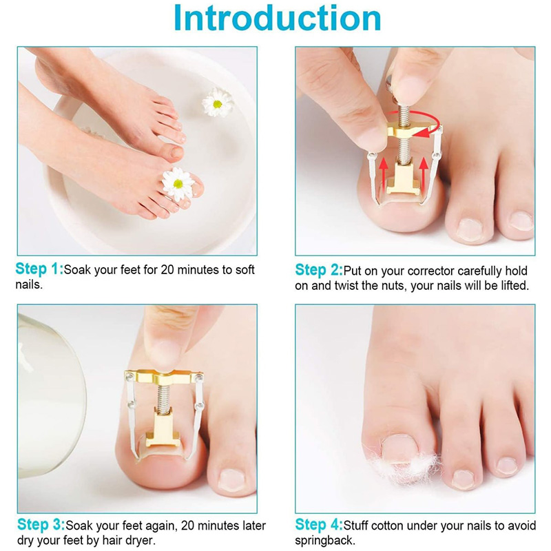 دستگاه اصلاح فرم و ارتودنسی ناخن مدل Nails